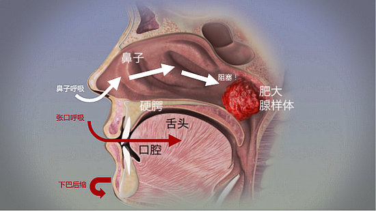 呼吸1.jpg